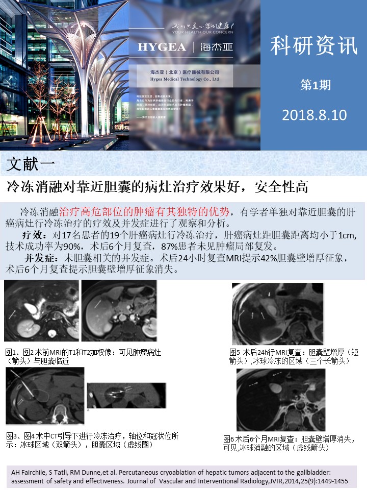 【海杰亞科研資訊】第1期——肝、肺癌消融